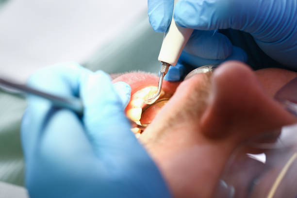 Best Emergency TMJ Treatment in Abingdon, VA