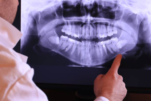 Best Weekend Emergency Dentist in Abingdon, VA