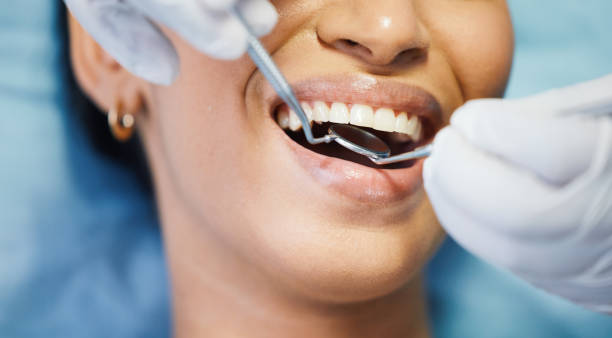 Best Pediatric Emergency Dentist in Abingdon, VA