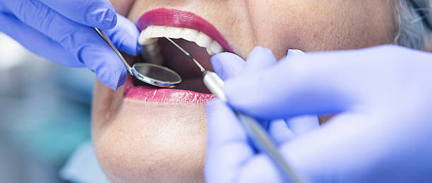 Best Emergency Treatment for Dental Infections or Abscesses in Abingdon, VA